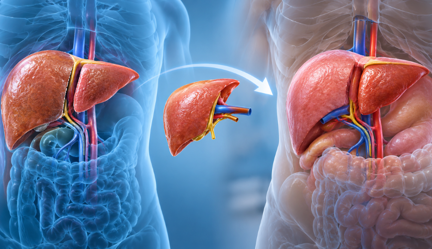 Living-Donor Liver Transplant