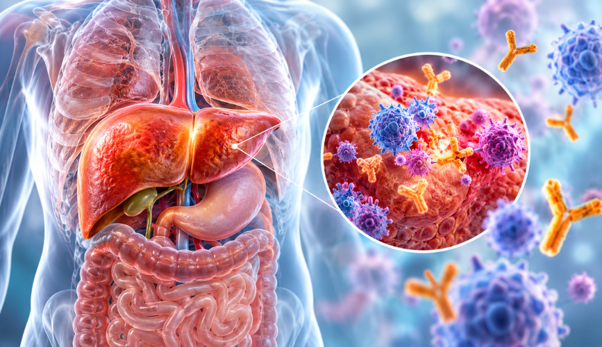 Autoimmune Hepatitis Diagnosis and Treatment