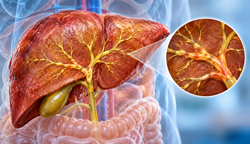 Primary Biliary Cholangitis PBC Treatment